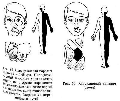 нога нога