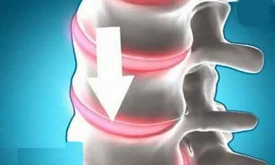 оценку эскиза