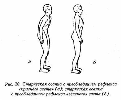 красный рефлекс