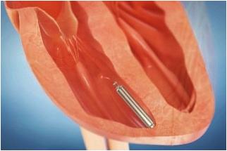 клинических опробованиях