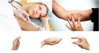 альцгеймера