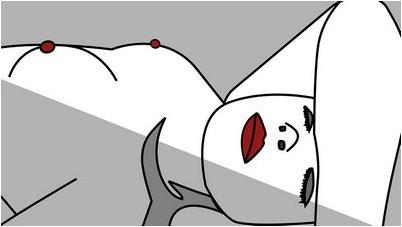 мастэктомия