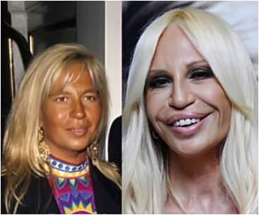 аутизма аутизма