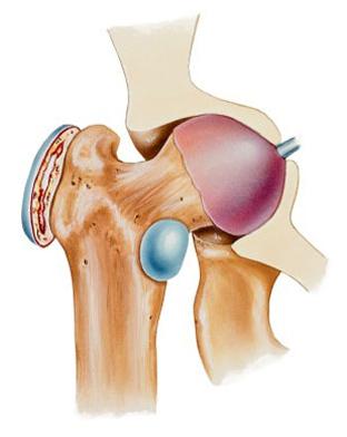 антибиотик антибиотик