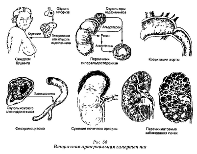 холестерин