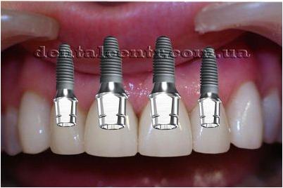 биоматериал