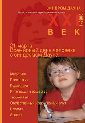 Исследование синдрома Дауна раскрывает терапевтические возможности болезни Альцгеймера