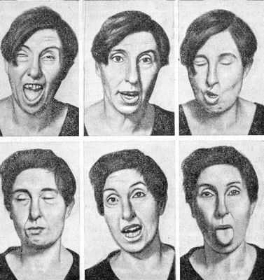 Опережая болезнь Хантингтона